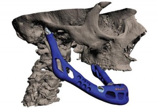 3D Printed Bone, future Transplantation