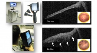 OCT, Stephen Boppart, 3D scanner, future device, University of Illinois Urbana-Champaign, futuristic gadget