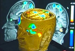 Scott Routley, technology news, technology and innovation, functional magnetic resonance imaging, fMRI, Bryan Young, vegetative state