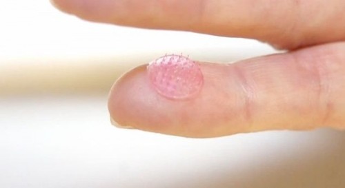 future, microneedle arrays, King’s College London, dried live vaccine, future technology, microneedle, tech news, medical technology, futuristic