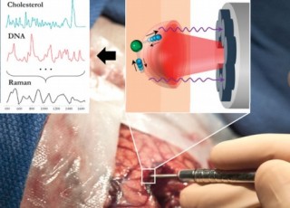 New Laser Probe Identifies Brain Cancer Cells In Real Time, The Future of Medicine, Neuroscience, Health, Neurotechnology