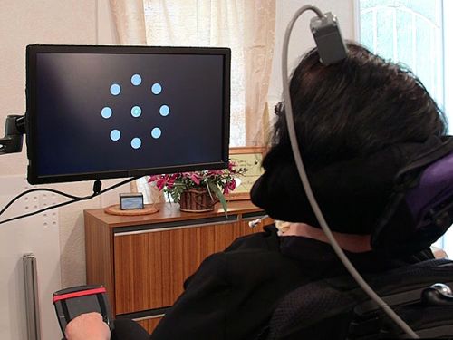 Paralyzed Person Uses A Brain-Computer Interface To Type. Neuroscience, Neurotechnology, Futuristic Technology