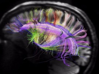 Neuroscience, The Ultimate Brain Map, Futuristic Technology