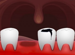 Regenerative Medicine, Could Humans Ever Regrow Teeth? The Future of Medicine